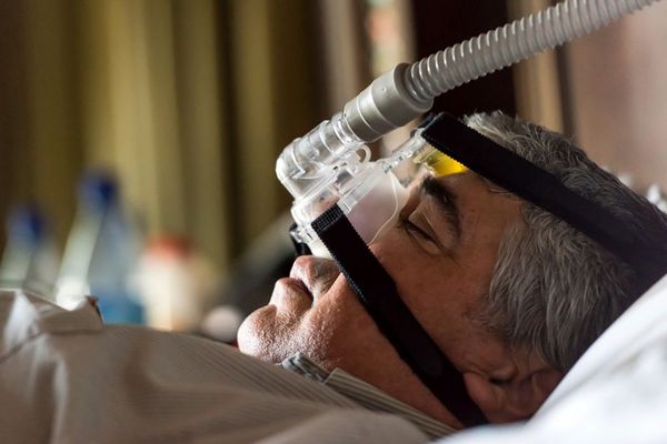 A man sleeps with a TAP appliance over his nose.
