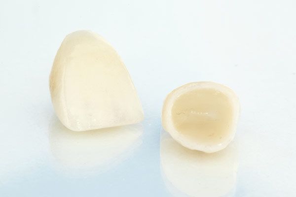 Dental crowns