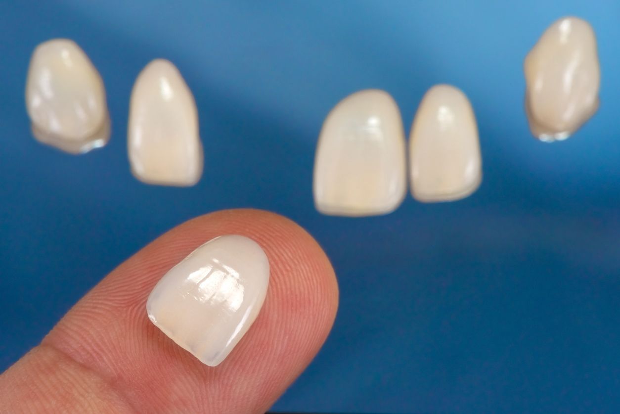 Veneer on fingertip